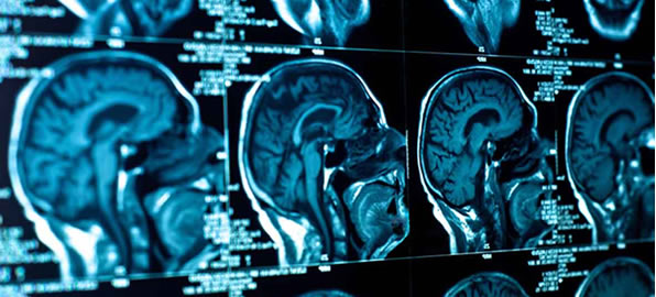 Neurologia Imagem